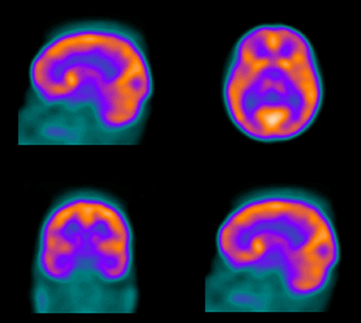 Four glowing images of the brain from different angles, in violet, orange, red, blue and yellow, on a black background