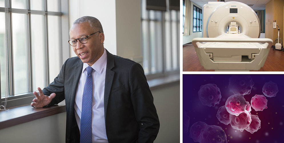 Composite of three images: William Blackstock Jr., MD, standing by a window talking; an MRI machine at Wake Forest Baptist; and an illustration of cancer cells