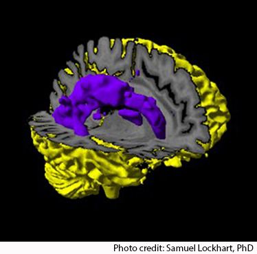 Alzheimer's Disease Research Center - brain graphic