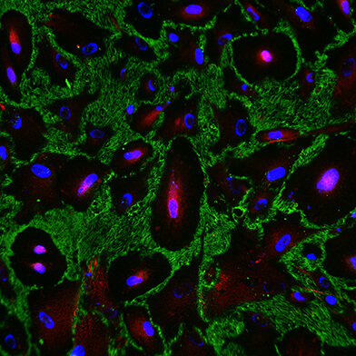 Cell and Gene Therapy Research